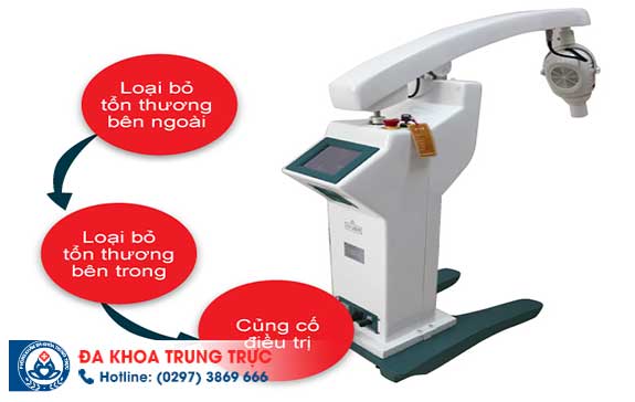 phuong phap ho tro chua sui mao ga hieu qua nhat