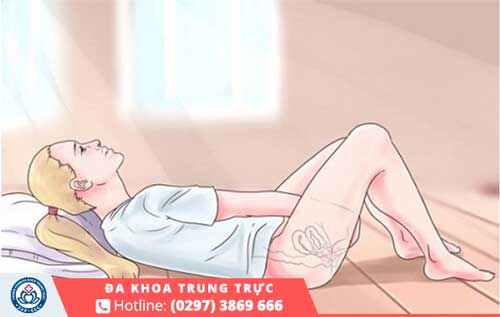 Các bước thực hiện sử dụng thuốc đặc trị nấm âm đạo