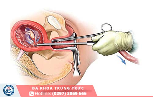 Phòng khám luôn áp dụng các phương pháp phá thai 3 tháng hiện đại và tiên tiến